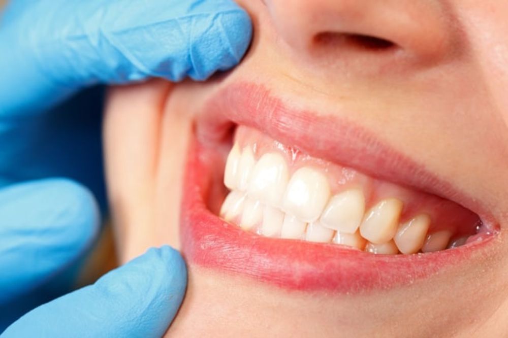sedation dentistry in saskatoon