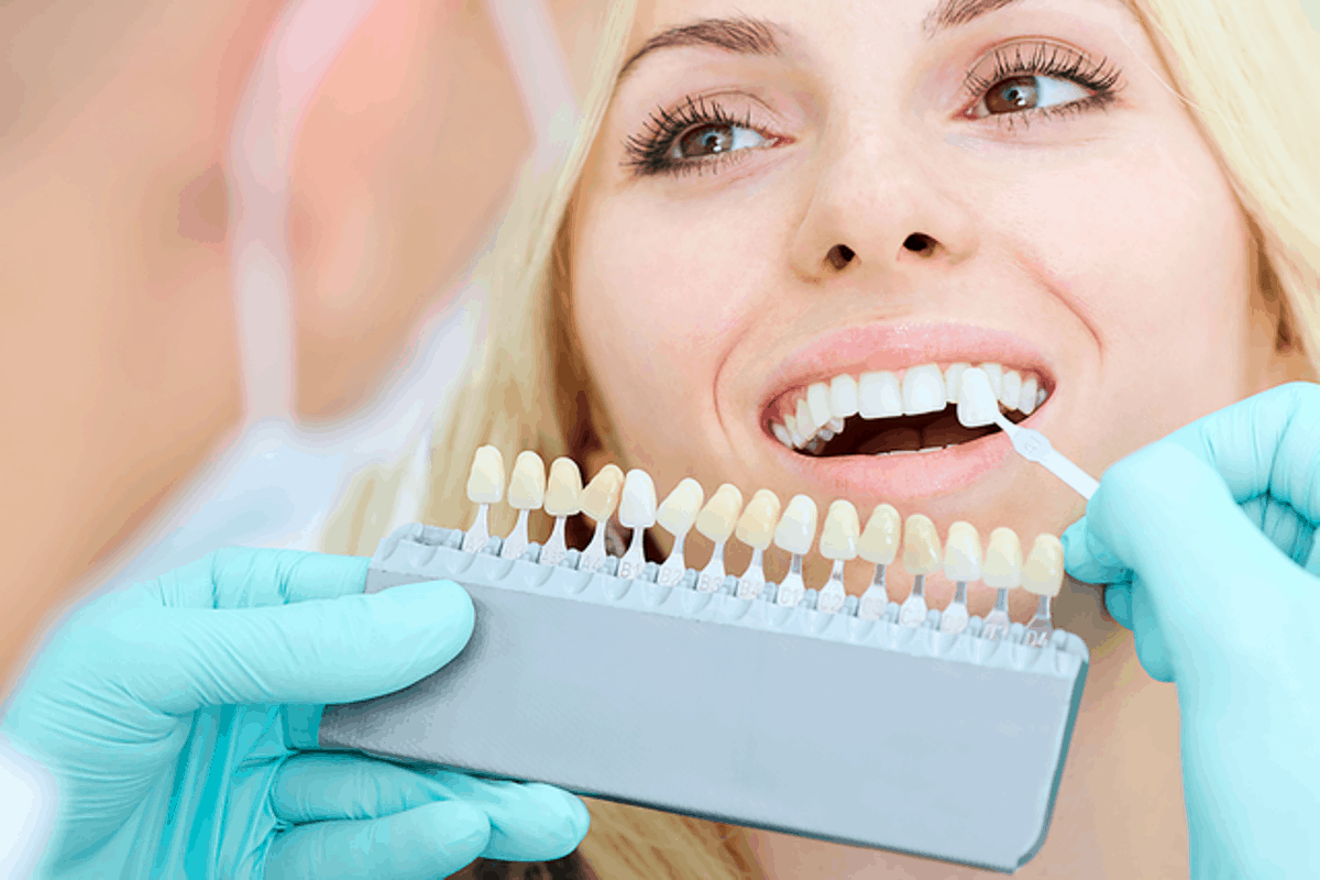 Teeth Whitening Safety Tips