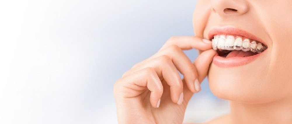 how often do i need to wear my invisalign retainers