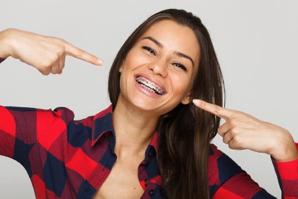 Braces Do More Than Create a Pretty Smile