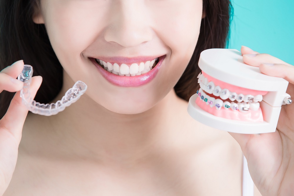 Invisalign vs braces which is more effective